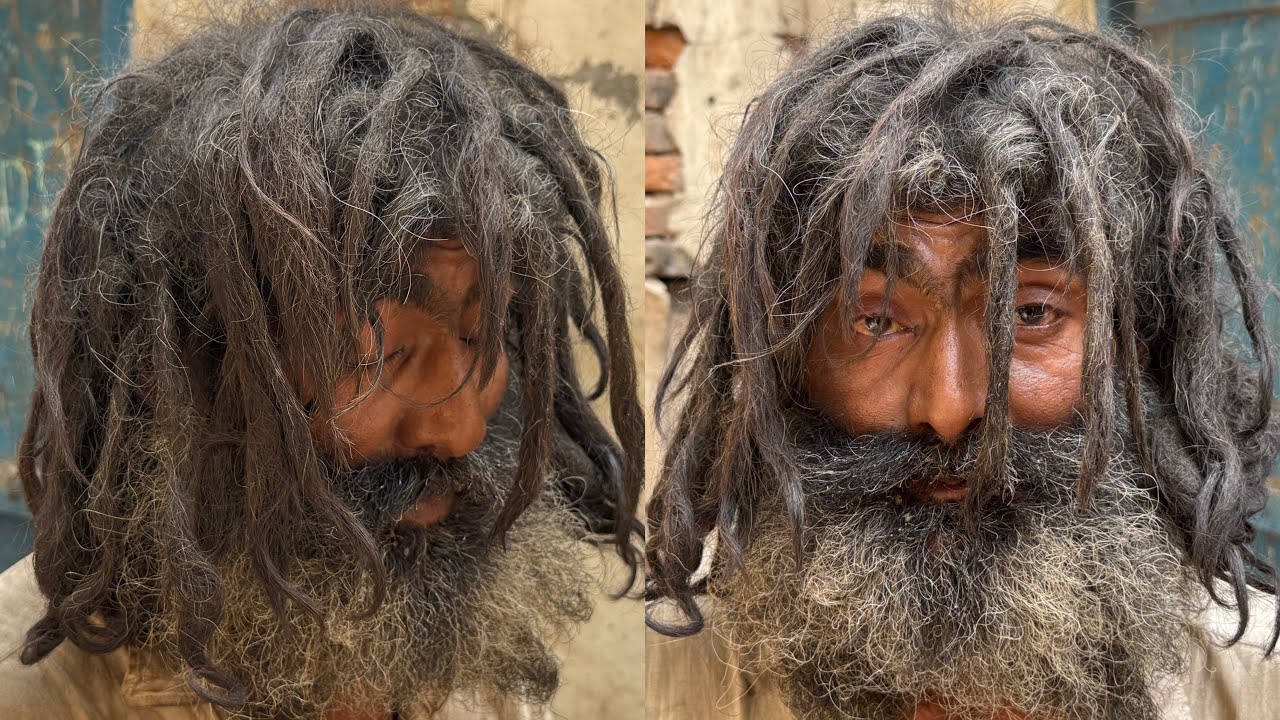 Homeless Man Became A Model | Given A Rich Life Transformation