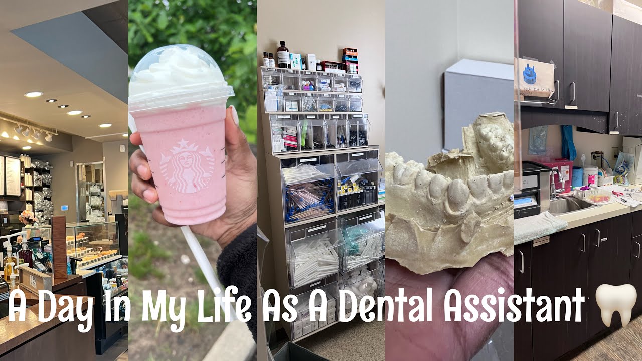 A Day in My life as A Dental Assistant 🦷💝 dentalassistant 