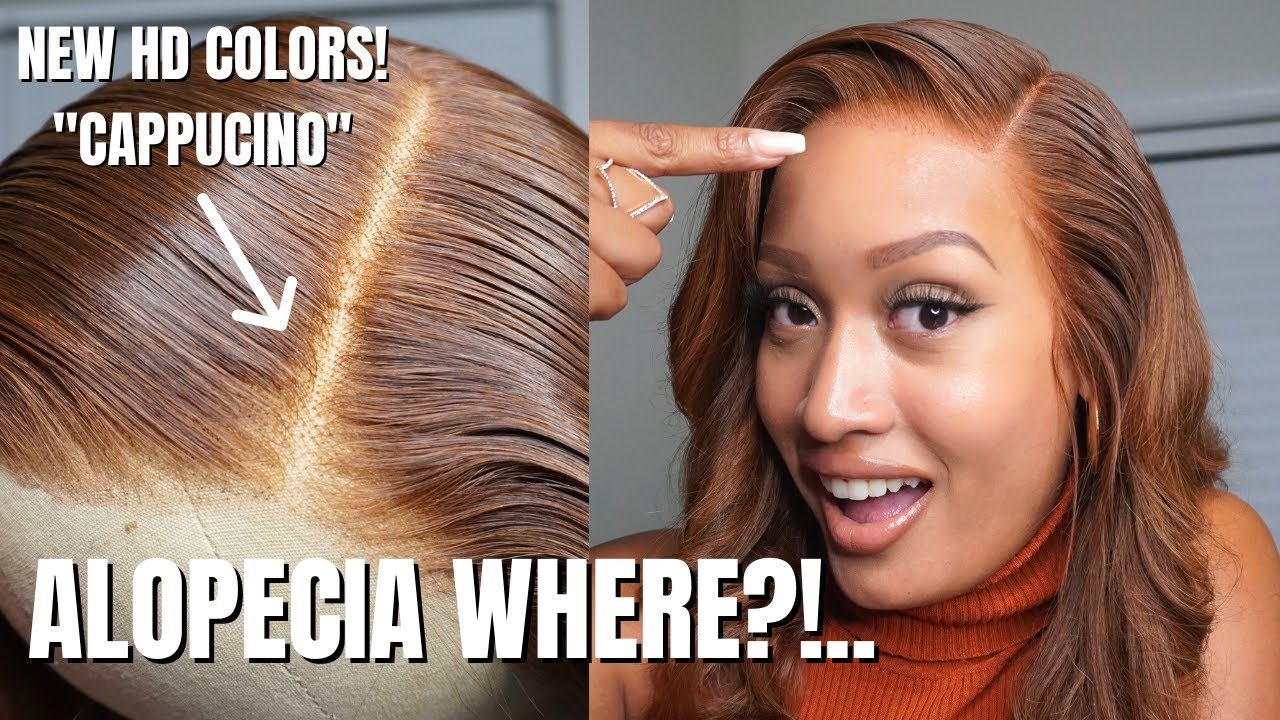 Я ПОТЕРЯЛА ВОЛОСЫ ИЗ-ЗА АЛОПЕЦИИ, НО HAIRVIVI ВЕРНУЛИ ИХ! СУПЕР РУКОВОДСТВО ПО НАТУРАЛЬНОМУ ПАРИКУ!!