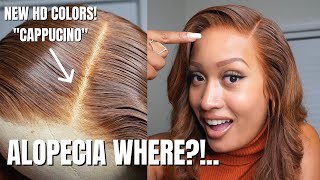 I LOST MY HAIR TO ALOPECIA, BUT HAIRVIVI GAVE IT BACK! CRAZY NATURAL WIG TUTORIAL!!