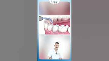 Công Nghệ Lấy Cao Răng Không Đau, Không Ê Buốt | Bác Sĩ Yên