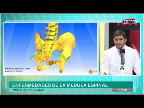 Vídeo: Degeneració De La Medul·la Espinal En Rottweilers