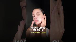 Хватит маскировать акне, пора с ним бороться. 4 шага, и кожа станет чище после первых применений👇🏻