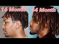 2 Year 9 Month Dreadlock Update | What's Going On With My Locks?! #starterlocks #dreadlockjourney