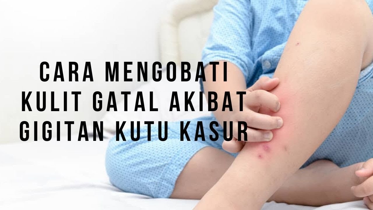Cara Mengobati Kulit Gatal Akibat Gigitan Kutu Kasur