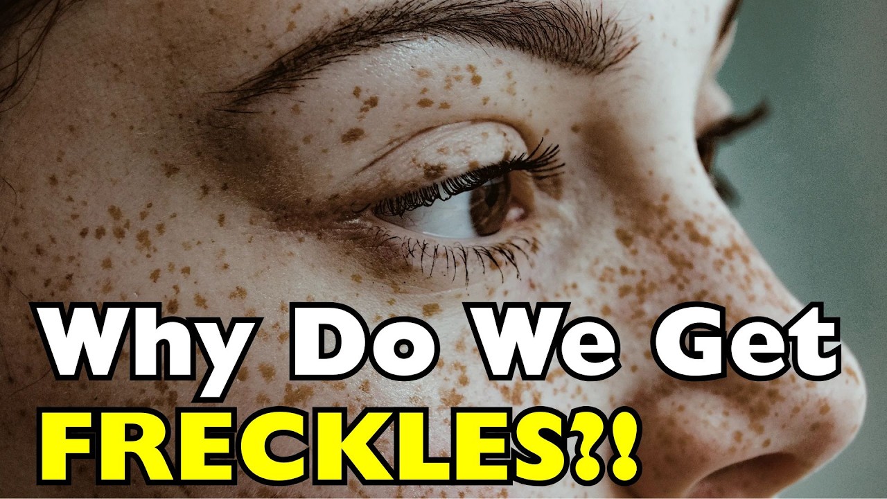 Why Do Some People Get Freckles? [ID0929]
