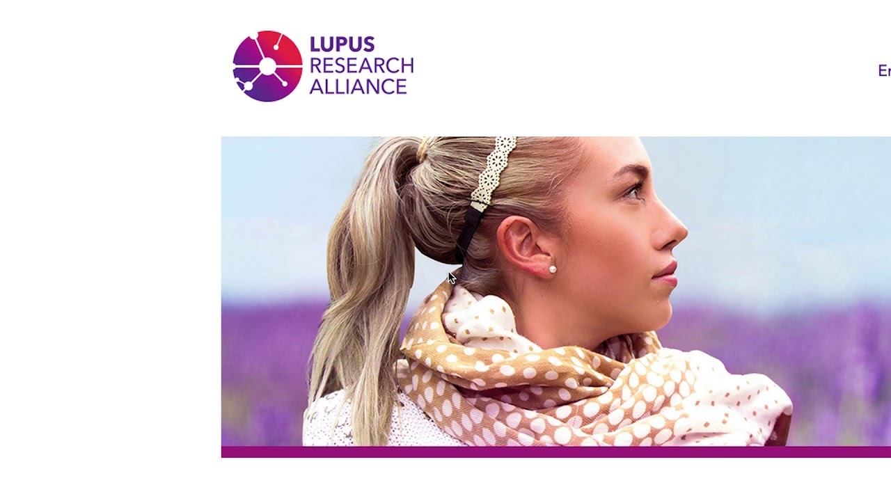 new research lupus