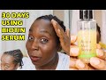 BIOTIN SERUM HAIR GROWTH RESULTS BEFORE AND AFTER |  1 MONTH DiscoveringNatural