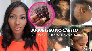 🚨 SENHORA DA ROÇA ME ENSINOU O SEGREDO PARA O CABELO CRESCER RÁPIDO EM UMA SEMANA 😱🔥