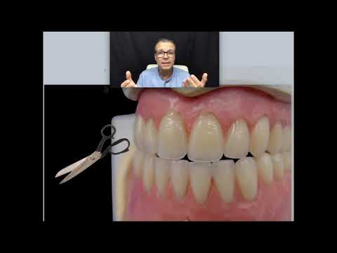 Vídeo: Os dentes de cima e de baixo devem se tocar?