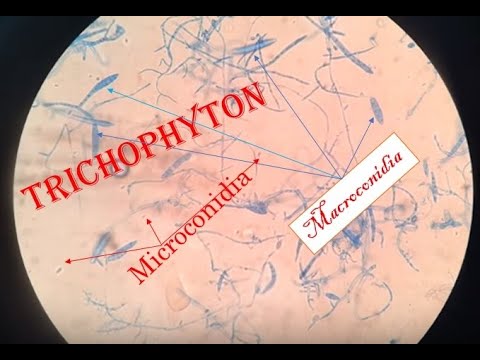 Vidéo: Où trouve-t-on le trichophyton rubrum ?