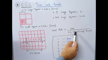 ECG Basics - Times and Speeds | Large and Small Squares/Boxes | Calculation of Heart Rate