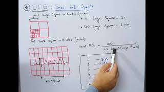 ECG Basics  Times and Speeds | Large and Small Squares/Boxes | Calculation of Heart Rate