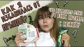 КАК НАВСЕГДА ИЗБАВИТЬСЯ ОТ ПРЫЩЕЙ? / ВСЁ О МАСКАХ ДЛЯ ЛИЦА