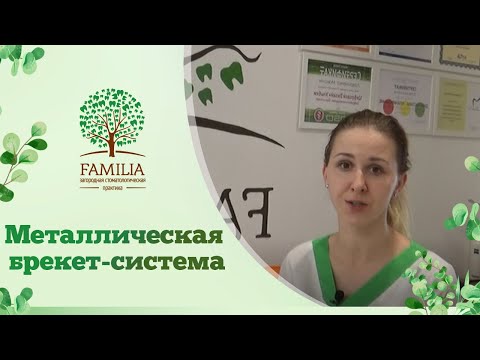 Металлическая брекет-система