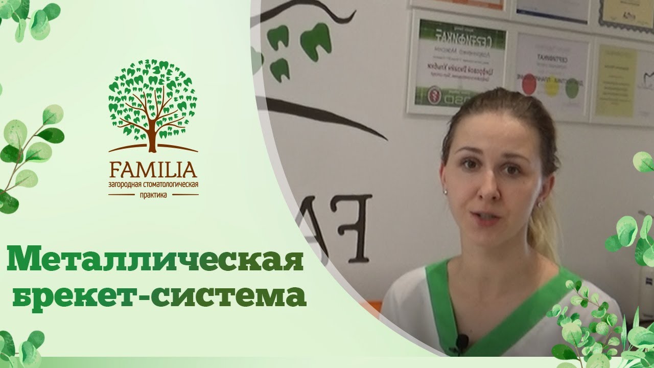 Металлическая брекет-система