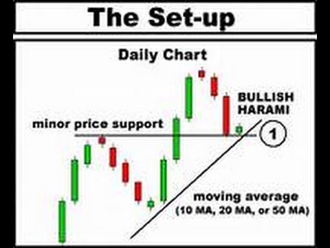 Stock Chart Setups