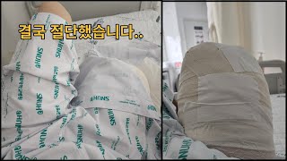 [병원 Vlog] 굿바이 오른다리