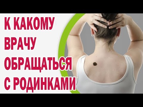 К какому врачу обращаться с родинками