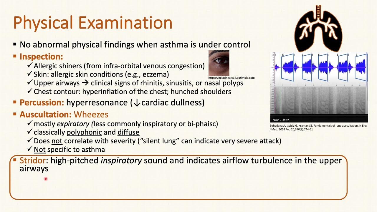 bronchial-asthma-history-and-exam-4-5-youtube