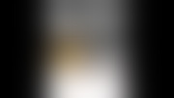 ERCP with Mechanical Lithotripsy and Stone Extraction of CBD #bsh #profmsarfin #gastroenterology