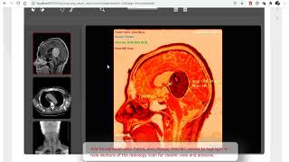 iCare Medical App - digital scans demo 🚑 | Request &amp; View MRI, X-Ray Scans Instantly