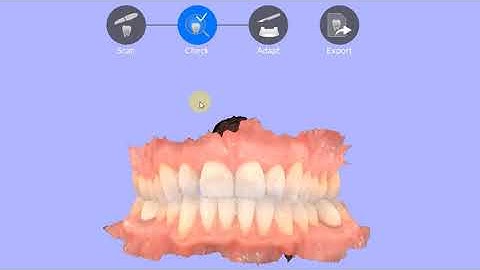 CS 3700 CS ScanFlow Ad Base