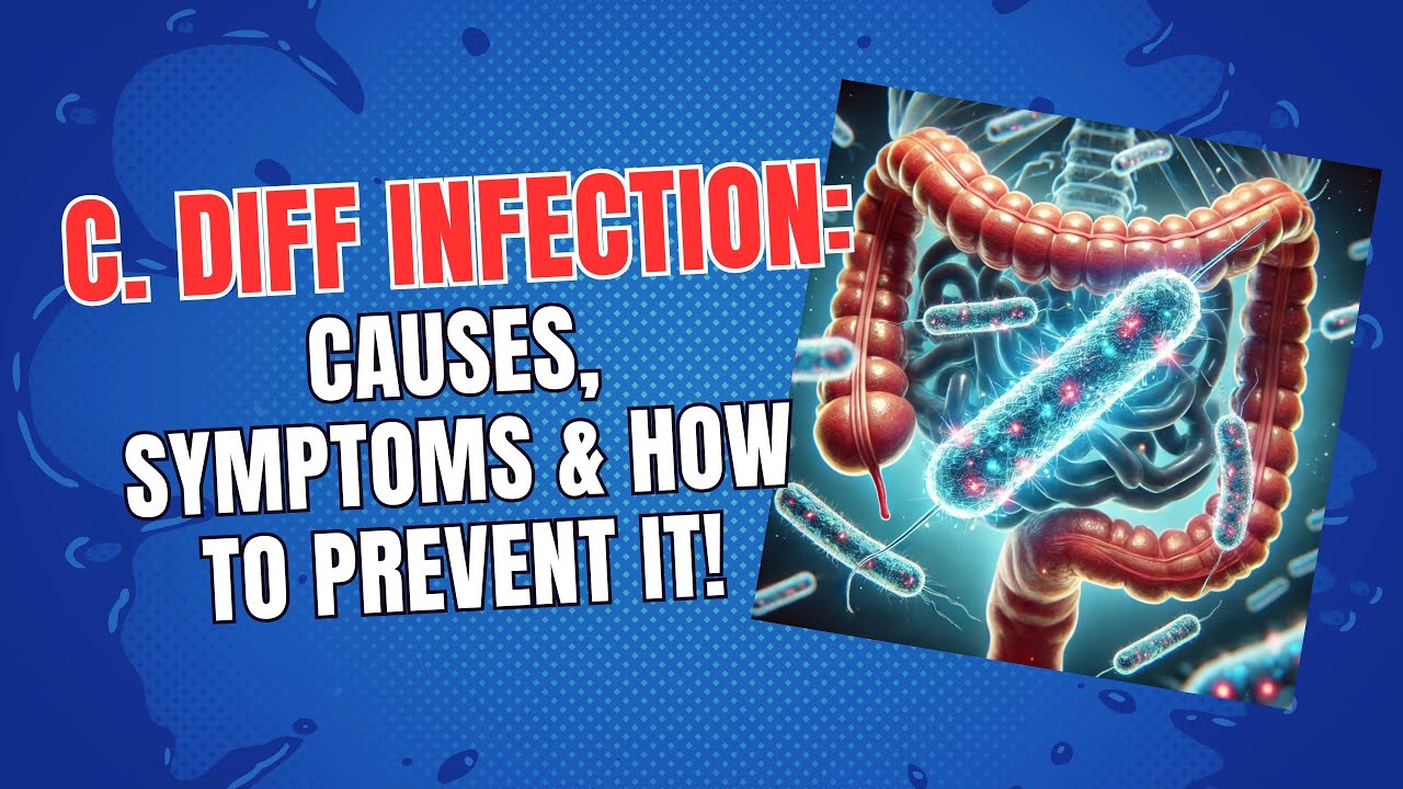 C. Diff Infection: Causes, Symptoms & How to Prevent It! - YouTube