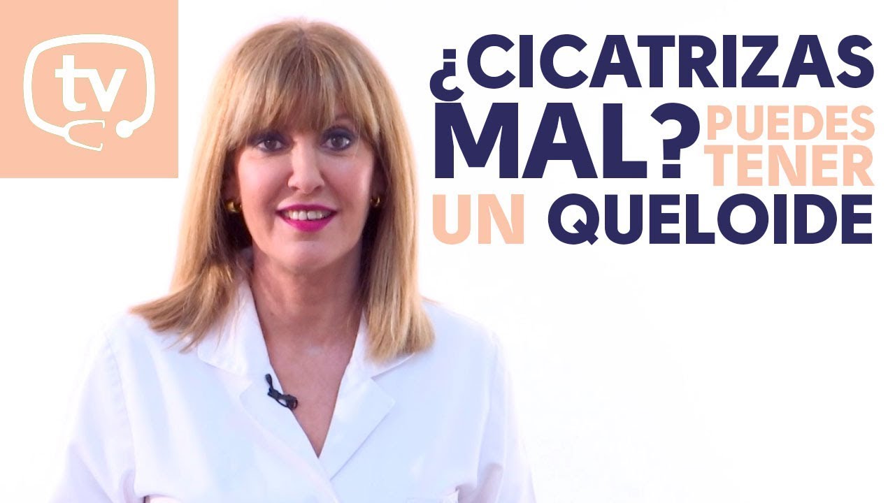 eliminar arrugas entrecejo remedios caseros ¿Cicatrizas mal? Puedes tener un queloide