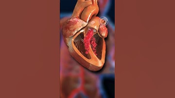 VÌ SAO BỊ NHỒI MÁU CƠ TIM | 😨 (Bạn Biết Không) #fact #thaukinhtrithuc #amazingfact