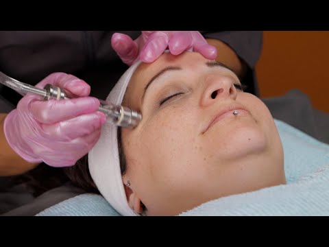 DiamondTome HydroWand Treatment - video from Altair Instruments