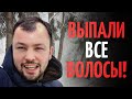 Выпали все волосы. Два месяца после пересадки