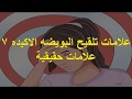 علامات تلقيح البويضه الاكيده 7 علامات حقيقية