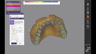 Exocad Monolitik Total Protez Kurs Part 2 Türkce