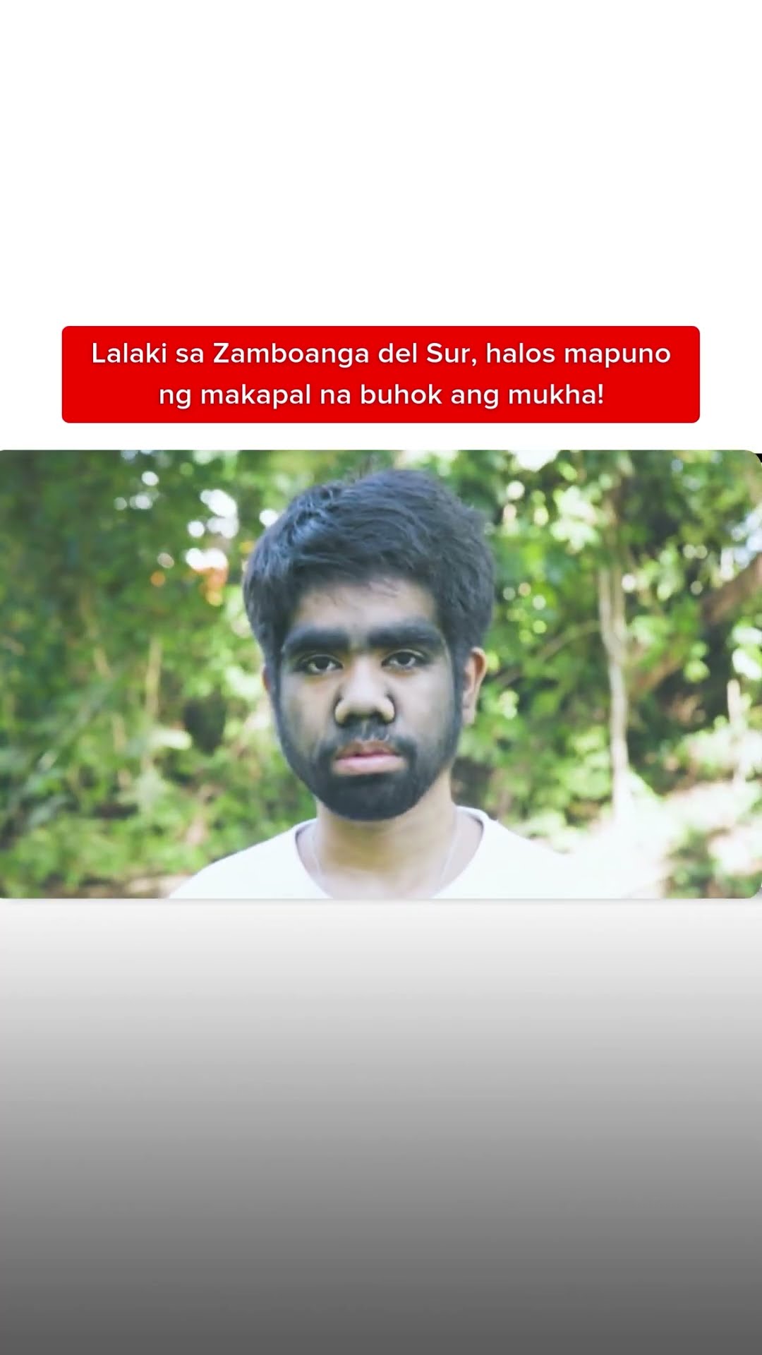 Lalaki sa Zamboanga del Sur, halos mapuno ng makapal na buhok ang mukha! | Kapuso Mo, Jessica Soho