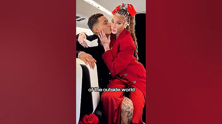 Billionaire only loves girlfriend with vitiligo#youtubeshorts #shorts #nba #basketball #Kyle #Kuzma