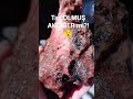 BU AKCİĞER TAŞ OLMUŞ😯❤️