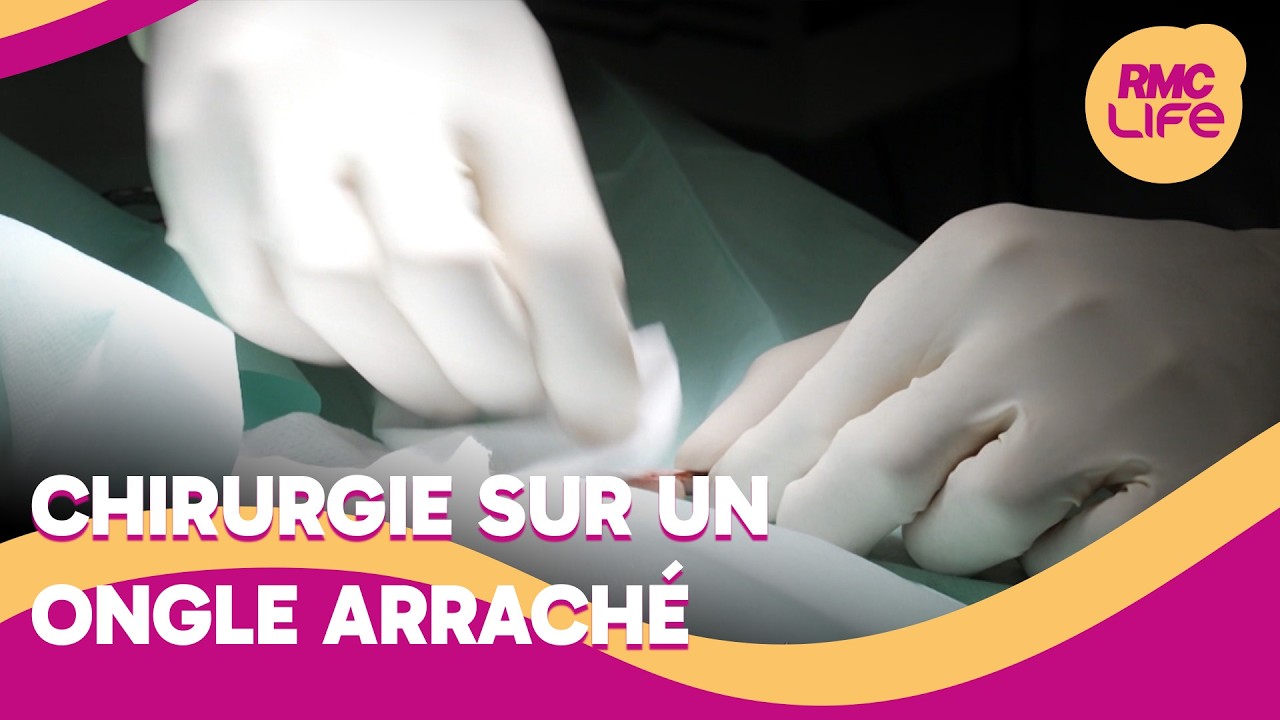 Elle arrive à l’hôpital avec un ongle arraché !
