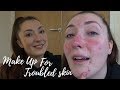 EVERYDAY MAKE UP FOR TROUBLED SKIN/ROSACEA//LAURENMEE