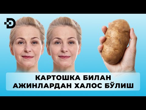 АЖИНЛАРДАН БУТУНДАЙ ХАЛОС