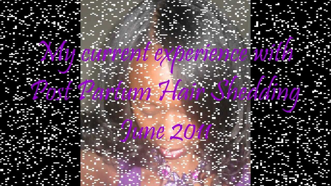 My Current Experience with Post Partum Shedding (Hair Shedding after