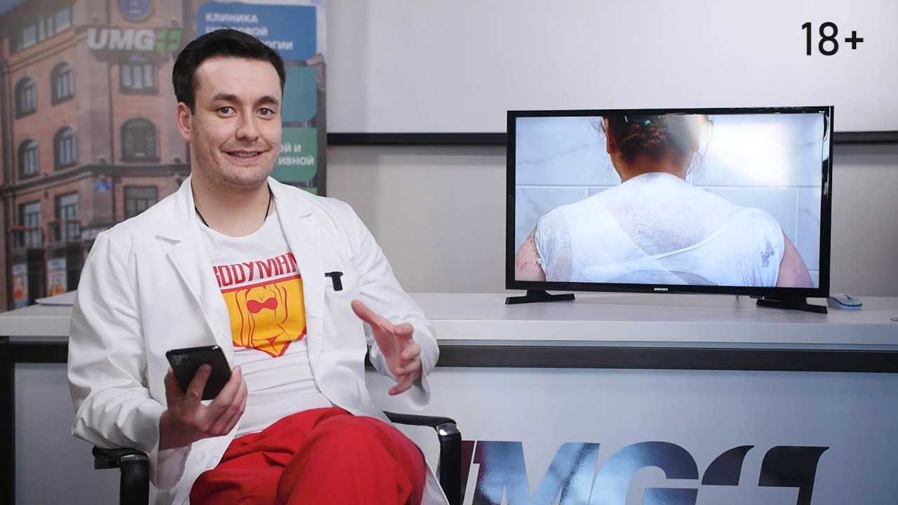 Вдовий горб. Что это такое и как от него избавиться? Чем поможет пластическая хирургия?