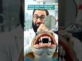 This Fish Has HUMAN Teeth?! 🦷 (Real Animal) #fish