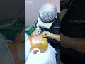 Best Price For Hair Transplant In India At Cara Clinic 2024 Best Price For Hair Transplant In India At Cara Clinic 2024