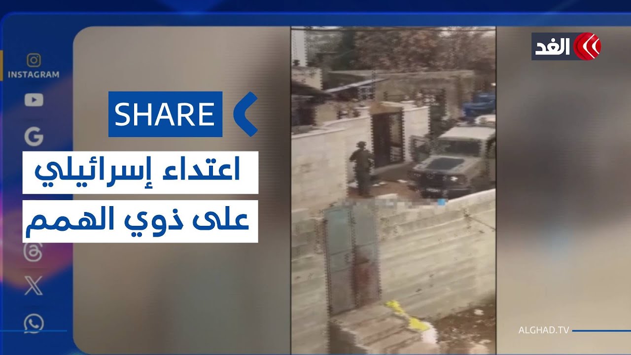 قوات الاحتلال تعتدي على شاب فلسطيني من ذوي الهمم في الضفة الغربية| 