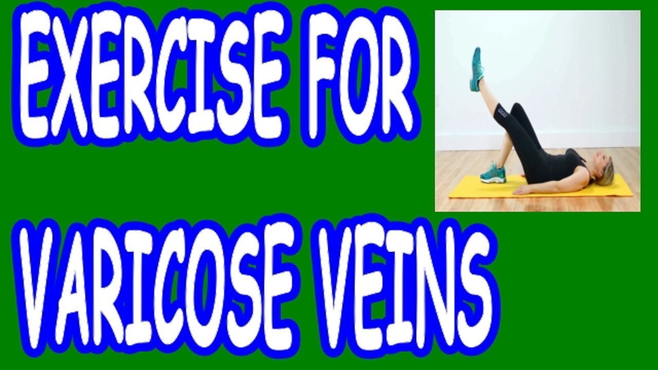 fitness cu varicose vena video)