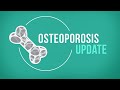 Osteoporosis Update 2017 - Research on Aging