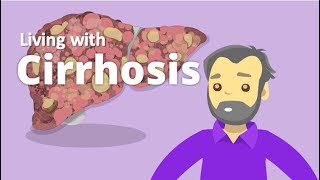 Cirrhosis – Living with cirrhosis