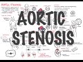 Aortic Stenosis - Overview (signs and symptoms, pathophysiology, treatment)