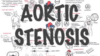 Aortic Stenosis  Overview (signs and symptoms, pathophysiology, treatment)